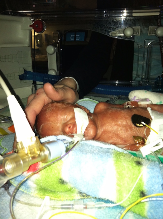 prematurity preemie the mighty