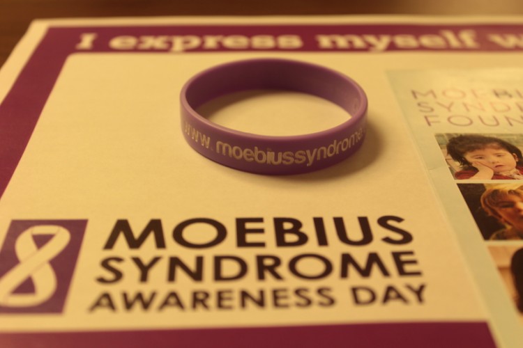 Celebrating diversity and raising awareness of Moebius syndrome. (Photo by Kelsey Ferrill /The Press)