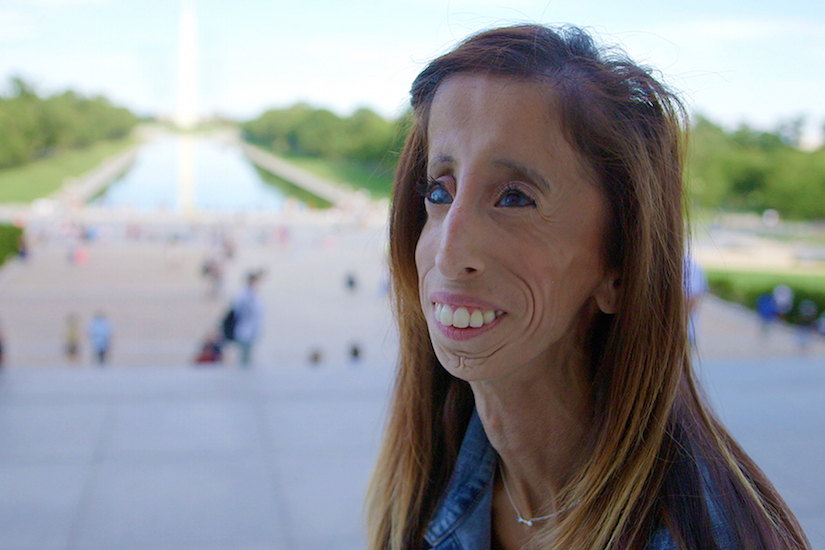 Lizzie Velasquez