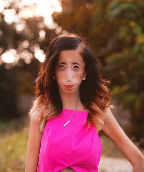 Lizzie Velasquez