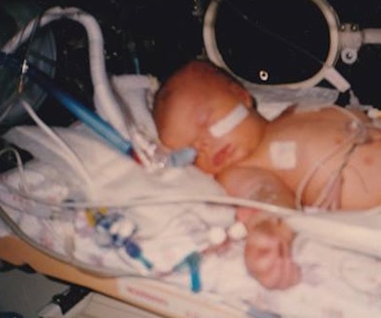 Photo of a baby in an incubator in the hospital