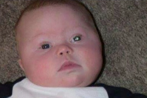 Photo of a baby where the flash has created a glow in the left eye. 