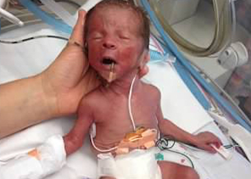 hand holding preemie baby in nicu