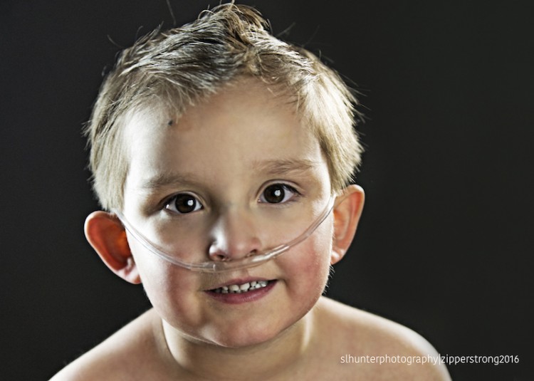 Boy with congenital heart defect