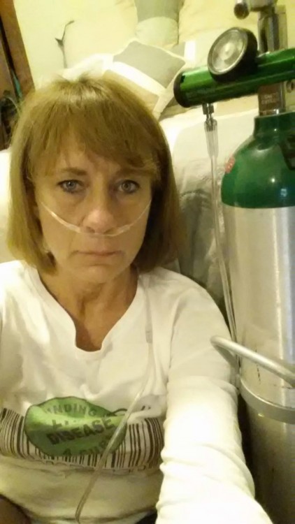 woman wearing oxygen tank