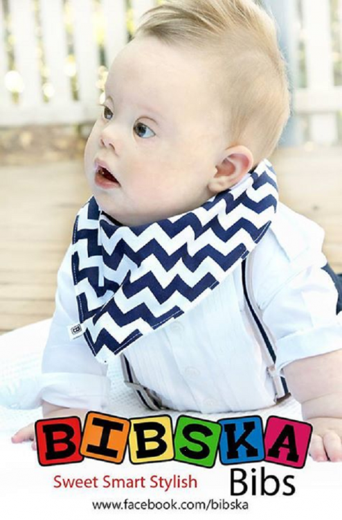 baby with Down syndrome modeling a bib