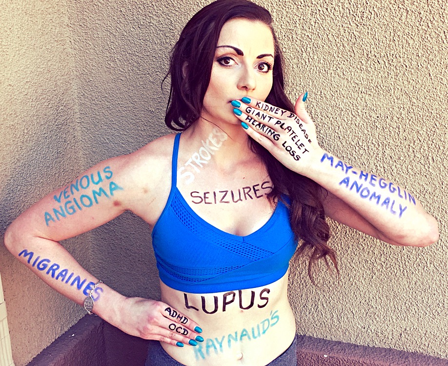 Woman wearing blue top with the words "seizures," "lupus," "migraines" and more diagnoses written on her upper body