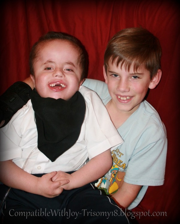 Rebekah's son with Trisomy 18 and his brother