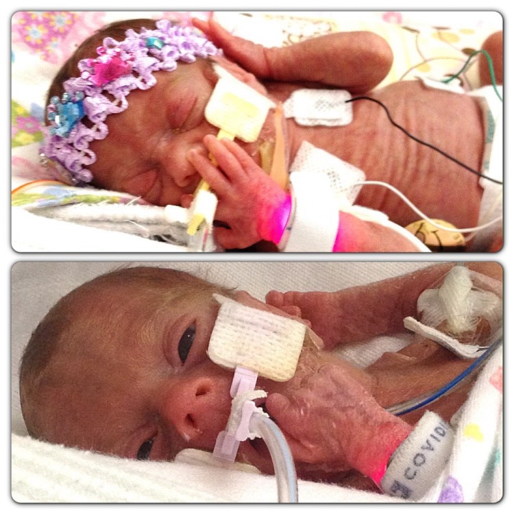 two newborn preemies in incubators