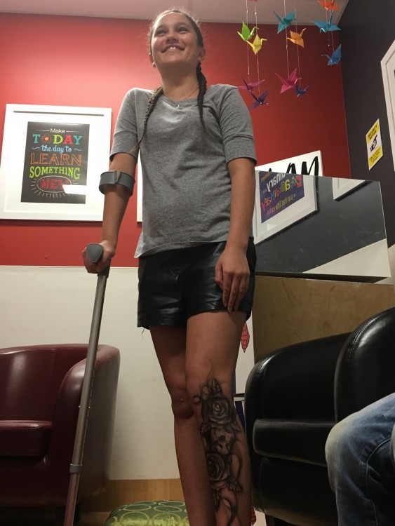 Girl with brace shows off her new tattoo
