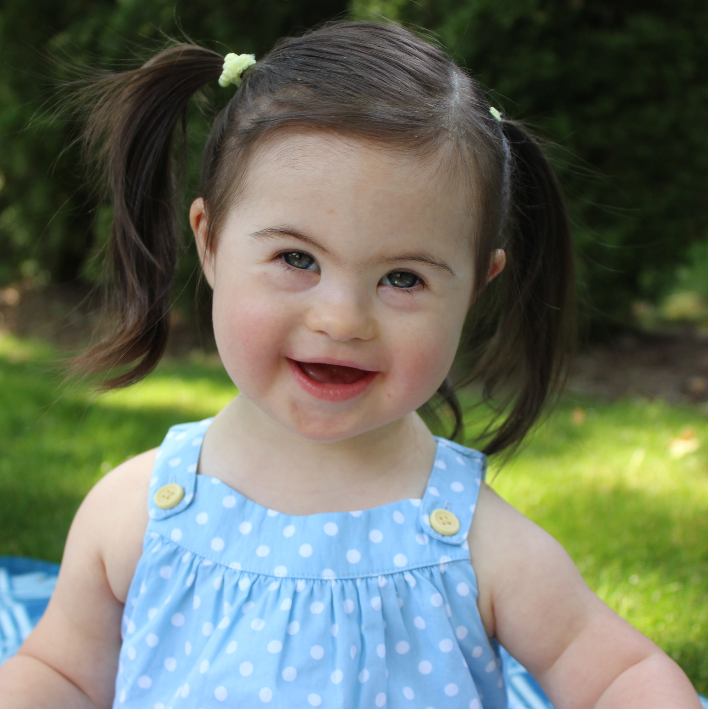 little girl with down syndrome