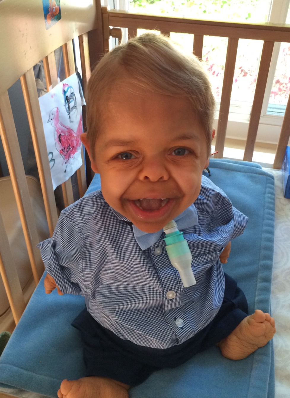 son with dwarfism smiling