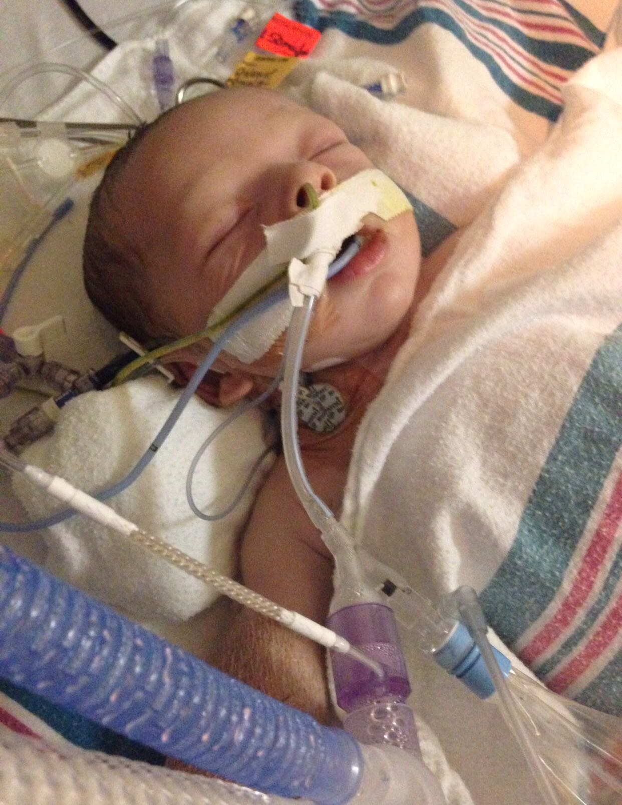 dallas in nicu