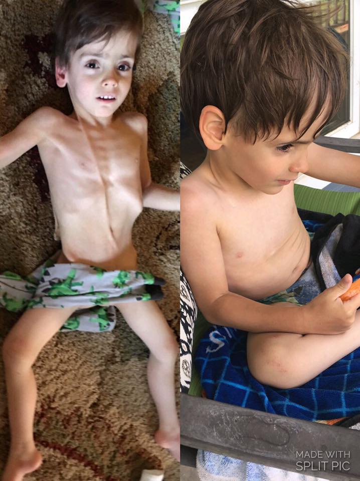 before and after shots of a boy who was adopted