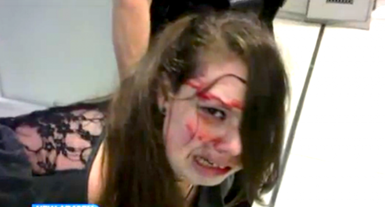 The young woman who was beaten by the TSA.