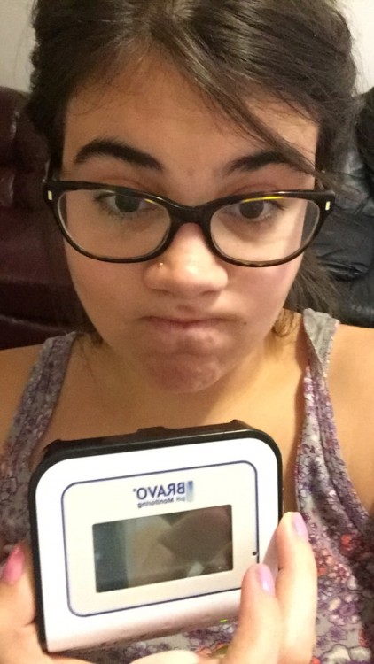 girl wearing glasses holding hospital monitor