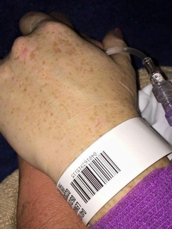 hospital bracelet on wrist