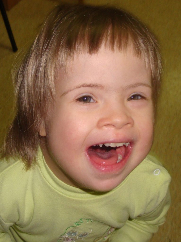 Lilya, a little girl wearing a yellow shirt and smiling.