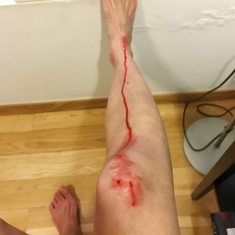 blood running down leg