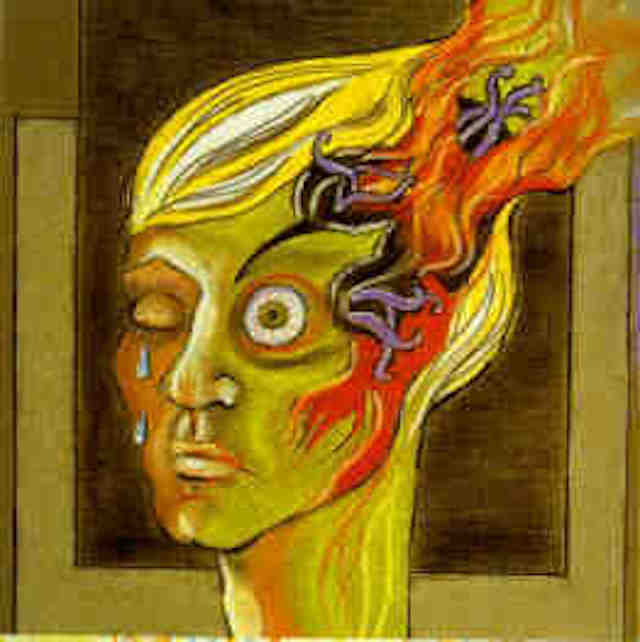 illustration of person having a migraine