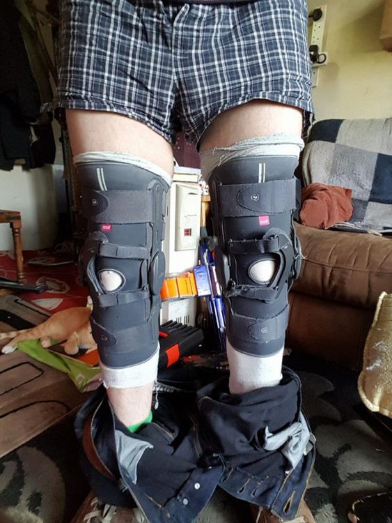 man with knee braces on both legs