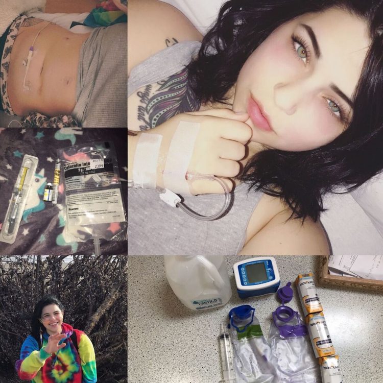 collage of photos of a woman in the hospital with gastroparesis
