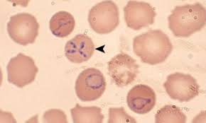 babesia in a cell