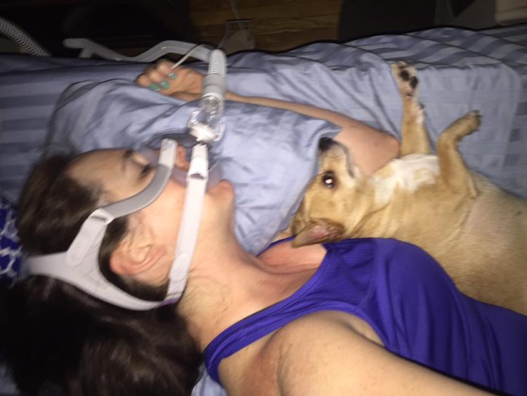 woman with a CPAP machine sleeping next to her dog
