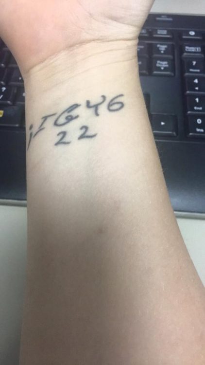 ;IGY622 tattooed on wrist