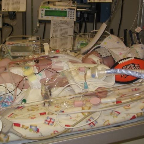 Baby in NICU 