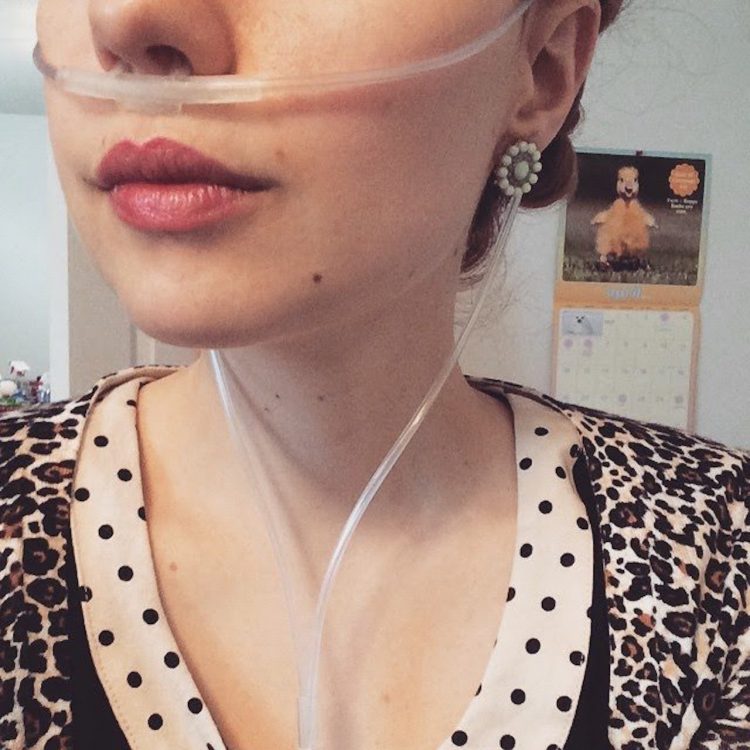 woman wearing a breathing tube