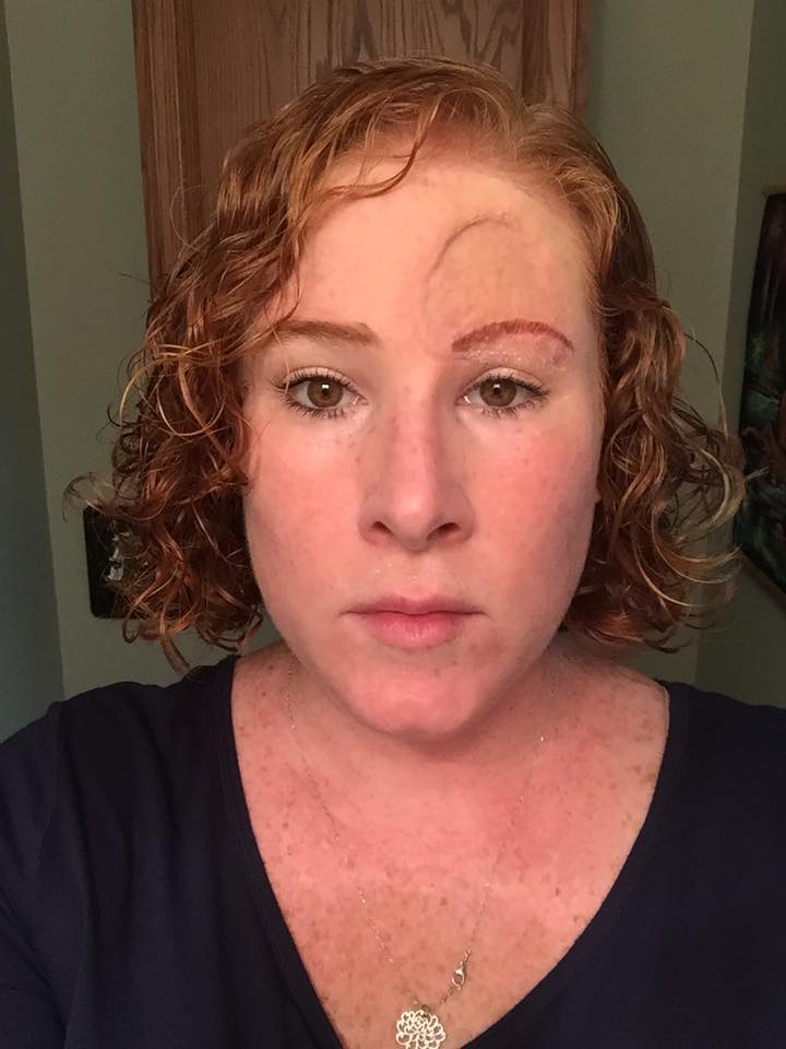 woman with melanoma cancer close up makeup