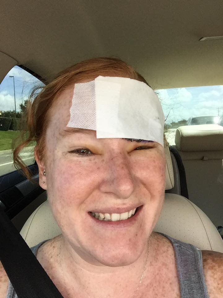 woman with melanoma cancer with bandage on head