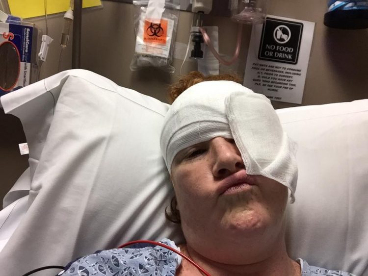 woman with melanoma cancer with bandage on head in hospital bed
