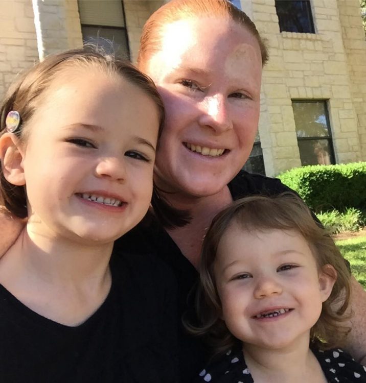 woman with melanoma cancer with kids