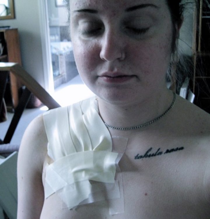 woman during lupus treatment with tape on her chest and a tattoo on her shoulder