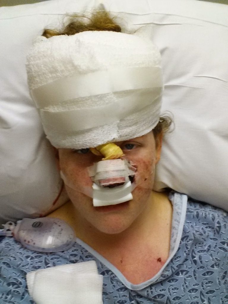 skin cancer woman after surgery