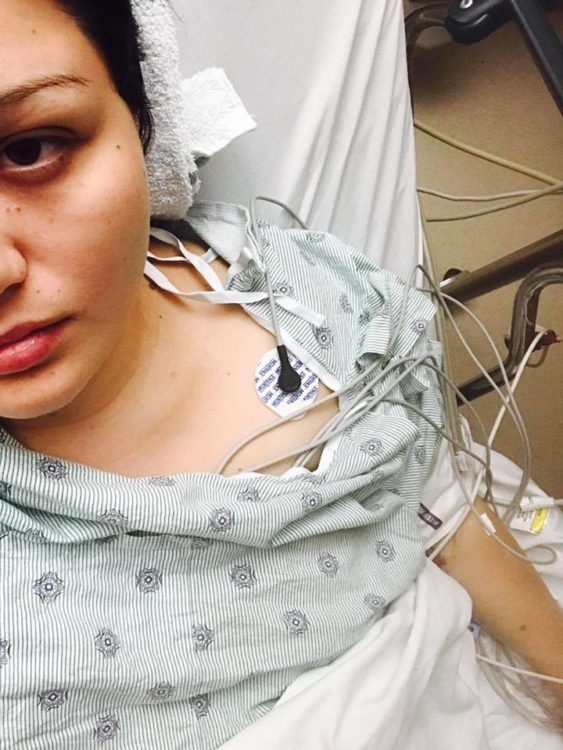 woman lying in a hospital bed wearing a hospital gown