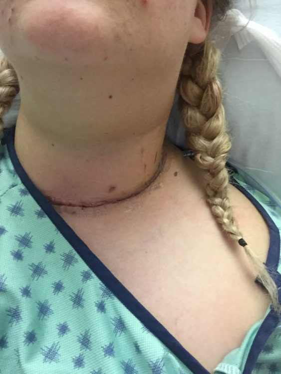 carina campanella neck surgery