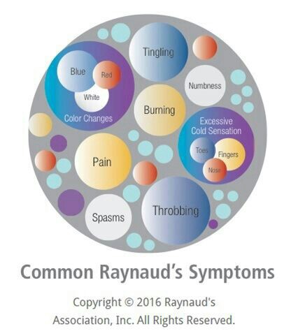 common raynauds symptoms