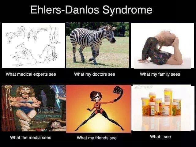 how different people view ehlers-danlos syndrome