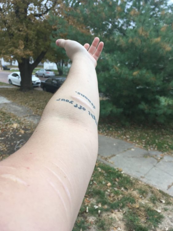 arm self-harm scars and tattoo saying fight off your demons