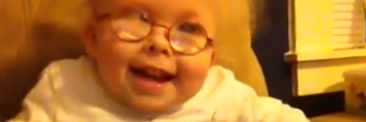 Conradi Hunermann Syndrome The Mighty Conradi Hunermann Syndrome The Mighty