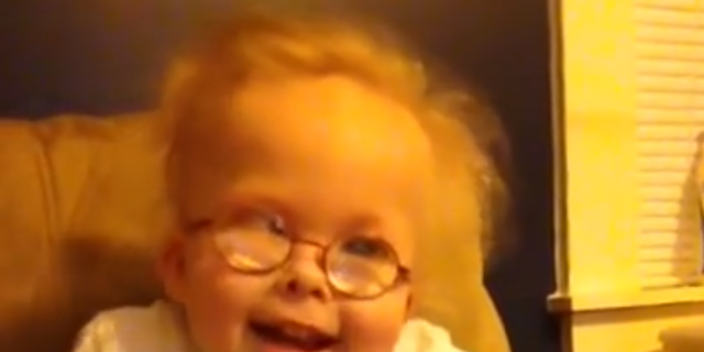 Conradi Hunermann Syndrome The Mighty Conradi Hunermann Syndrome The Mighty