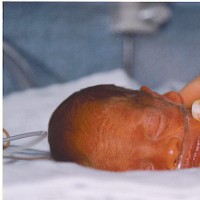 Baby in NICU with a hand on the baby's back