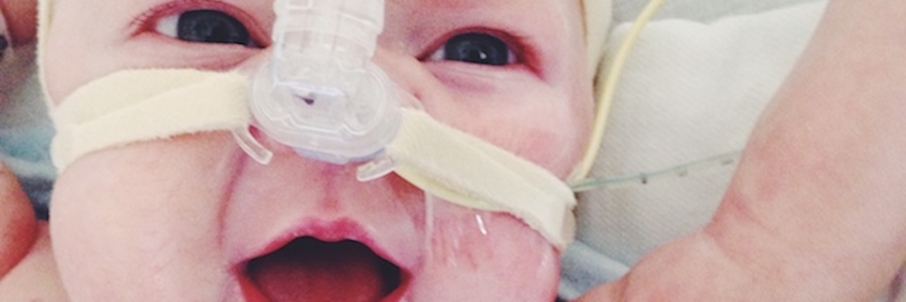 Words of Support for Mothers of Very Sick Children Boy with scars on his chest hooked up to a medical device while smiling at the camera