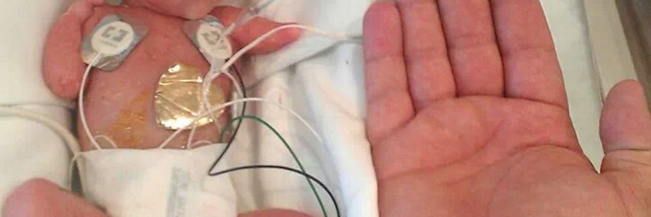 What I Wish I'd Known When My Baby Was Born the Size of My Hand