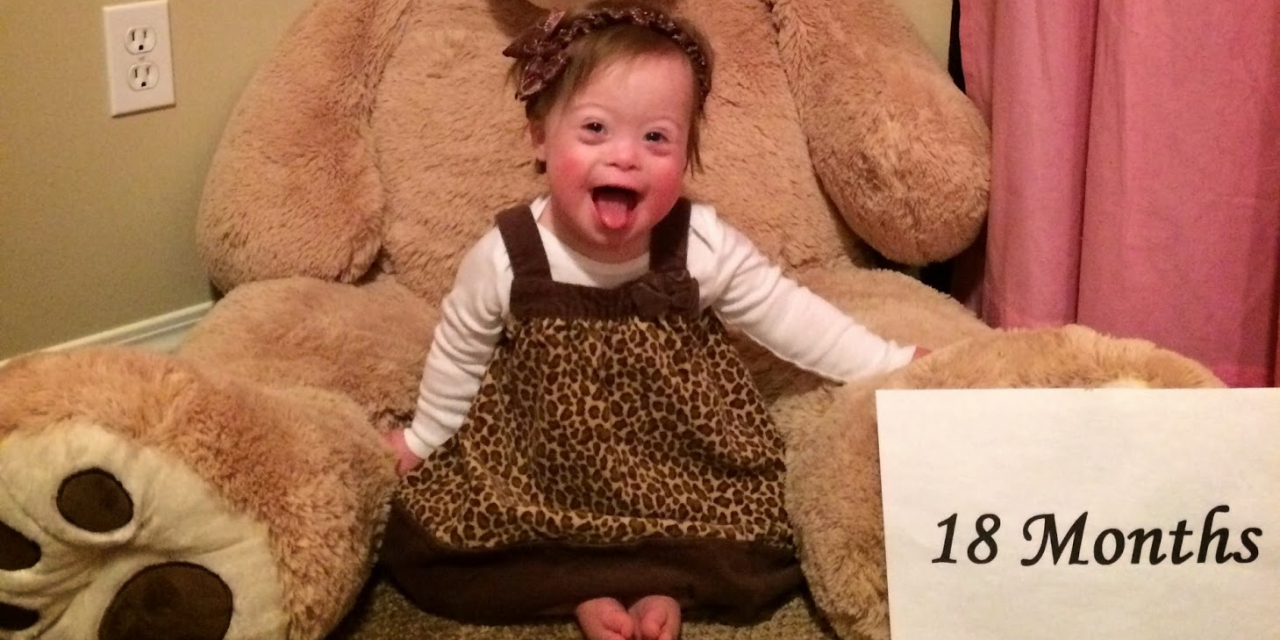 How to Talk With Your Child About Down Syndrome