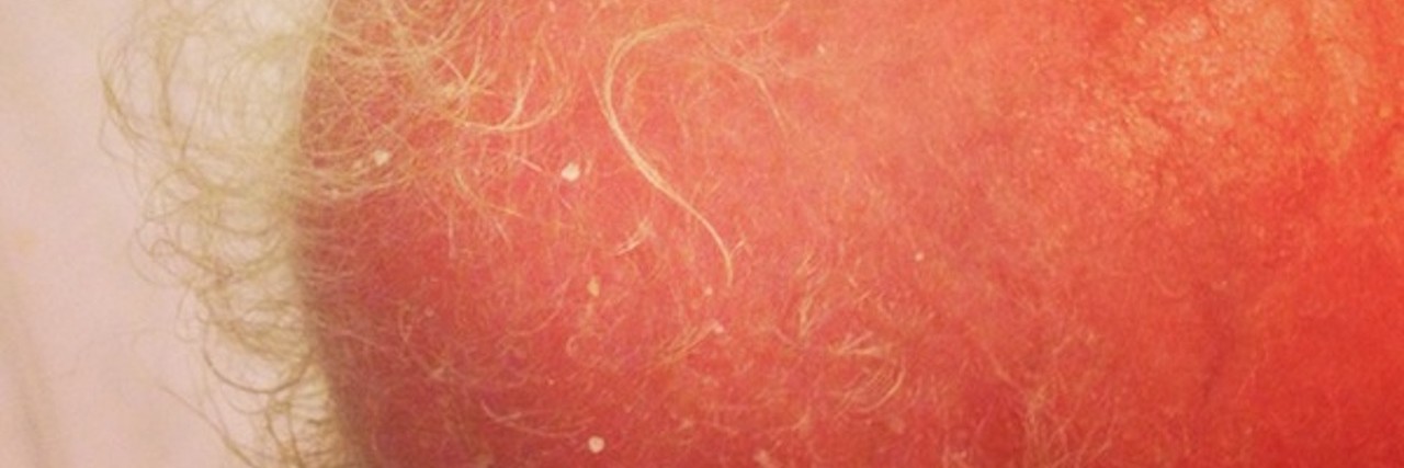 We Never Guessed Our Daughter's Pigtails Would Teach Us So Much