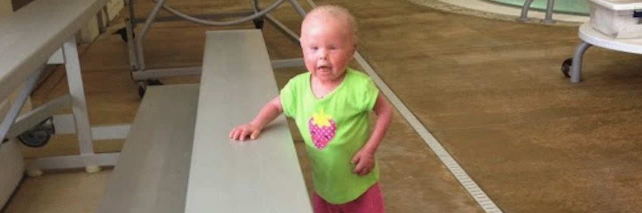 Remembering That My Daughter With Ichthyosis Is Different Courtney's daughter